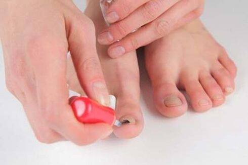 Nagellack