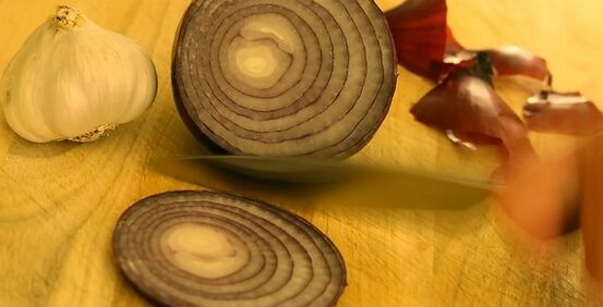 Knoblauch und Zwiebeln zur Behandlung von Nagelpilz.